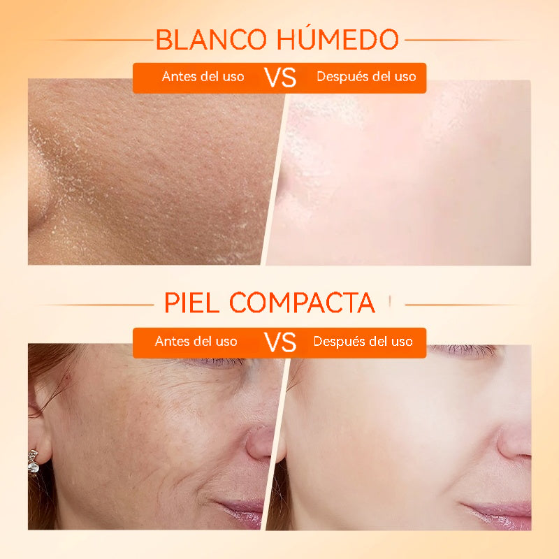 Vitamin C Brightening Cream（Buy 1, Receive 2 Products!）